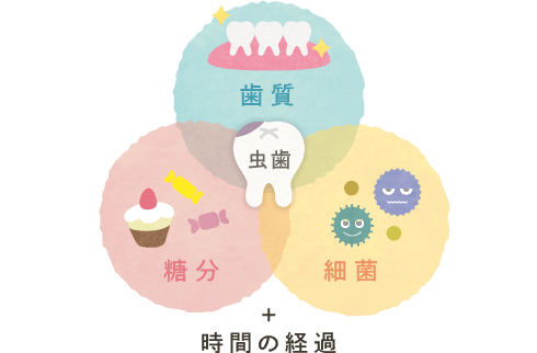 虫歯＝歯質+糖分+細菌+時間の経過