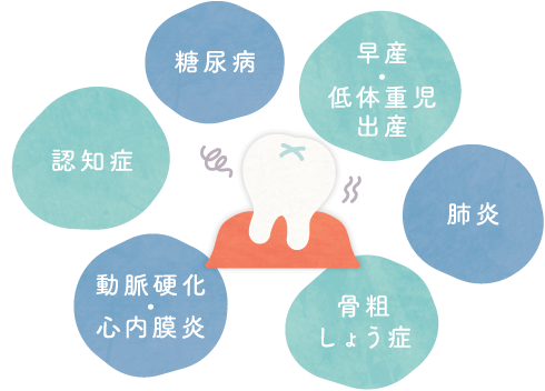 肺炎、糖尿病、骨粗しょう症、動脈硬化、心内膜炎、認知症、早産、低体重児出産